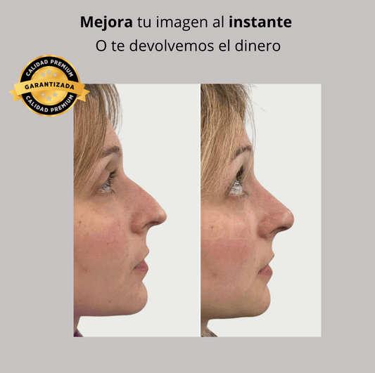 Corrector de Nariz